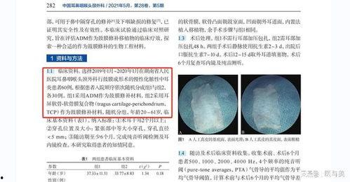 鼓膜手术视频,高清视频带你直观了解